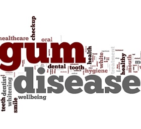 Words at dentist relating to gum disease.